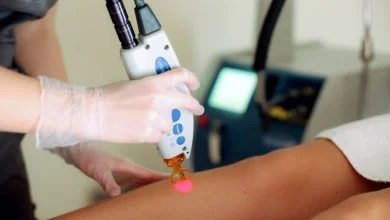 راهنمای لیزر موهای پوست برنزه-بهترین دستگاه لیزر پوست برنزه