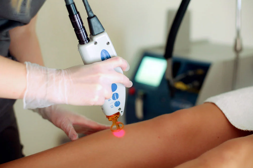 راهنمای لیزر موهای پوست برنزه-بهترین دستگاه لیزر پوست برنزه