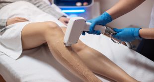 How Long Does Laser Hair Removal Last? | spa810