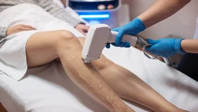 How Long Does Laser Hair Removal Last? | spa810