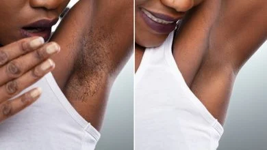 بهترین روش لیزر موهای زائد برای پوست های تیره و سبزه