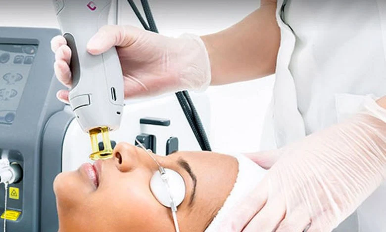 تفاوت دیوایس های لیزر جهت از بین بردن مو | بین دیوایس های لیزر مو چه فرقی در عملکردشان است؟