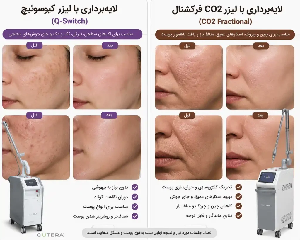 بررسی مقایسه هزینه لیزر پوست با دیگر روش های درمانی