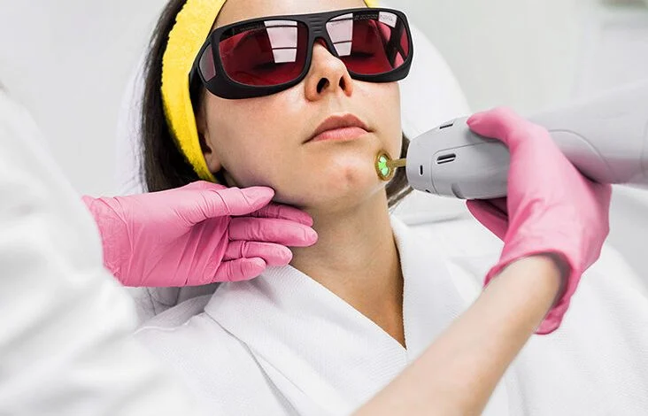 تعدادجلسات مورد نیاز برای لیزر موی بدن