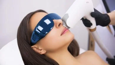 نکات حائز اهمیت در انجام لیزر مو