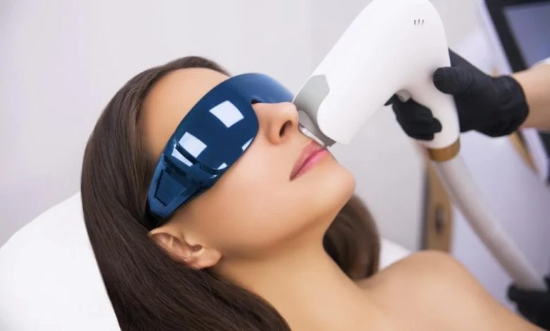 نکات حائز اهمیت در انجام لیزر مو