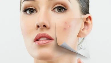 رفع جای زخم و اسکار با استفاده از درمان های نوری