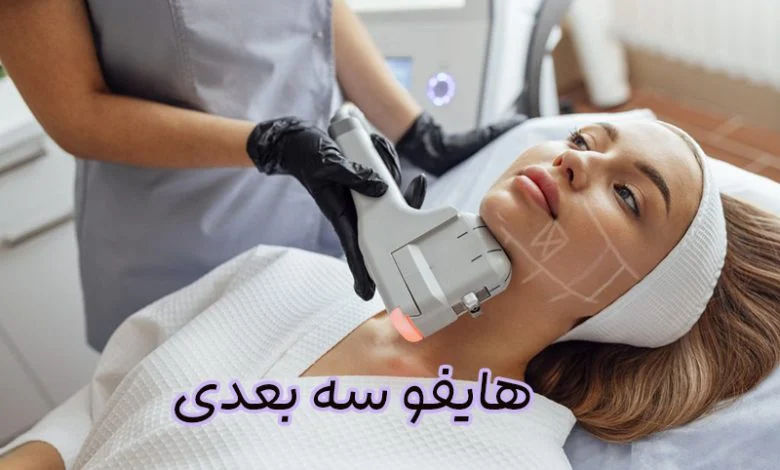 هایفو سه بعدی
