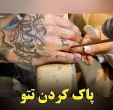 بهترین مرکز لیزر تاتو