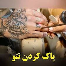 بهترین مرکز لیزر تاتو