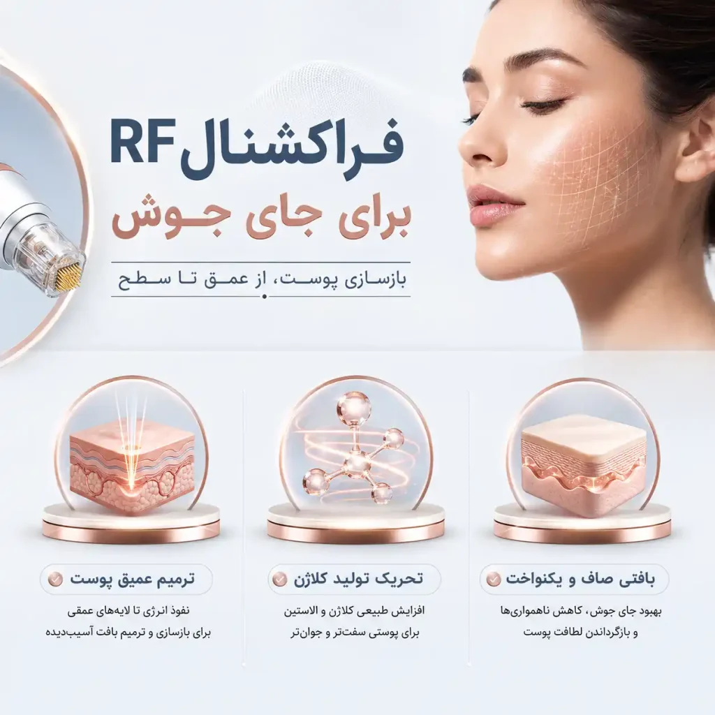 فرکشنال-optimized آر اف فرکشنال برای جای جوش
