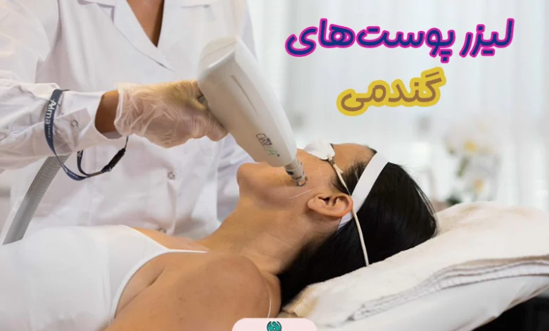 لیزر پوست های گندمی