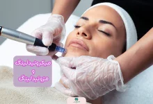 میکرونیدلینگ و مزونیدلینگ