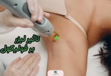 تاثیر لیزر بر فولیکول ها