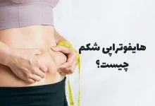 هایفوتراپی شکم