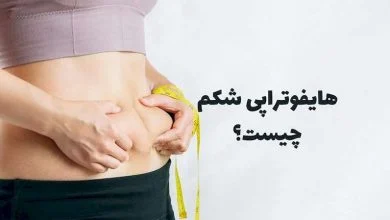 هایفوتراپی شکم