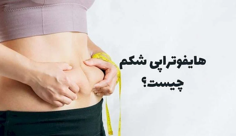 هایفوتراپی شکم