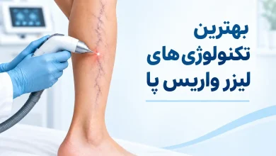 بهترین دستگاه لیزر واریس پا