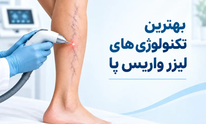 بهترین دستگاه لیزر واریس پا