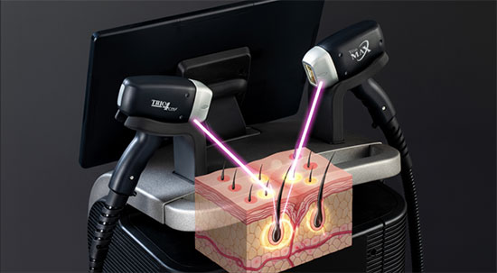 چیلر-خنک-کننده